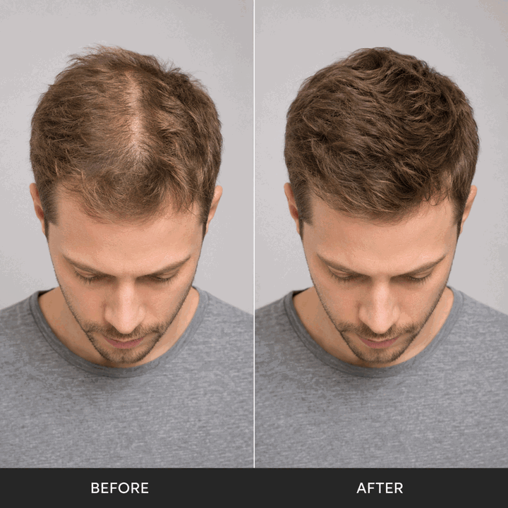NAVOZILO before and after hair volume comparison