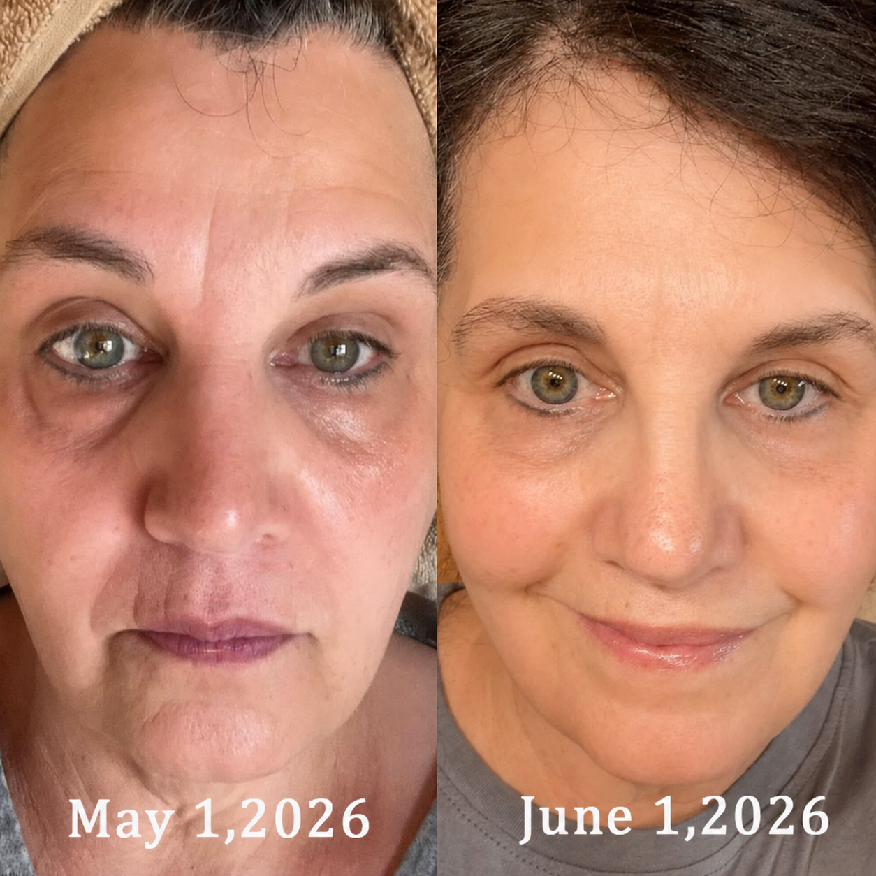 Real customer feedback showing brighter eye area and smoother-looking facial skin