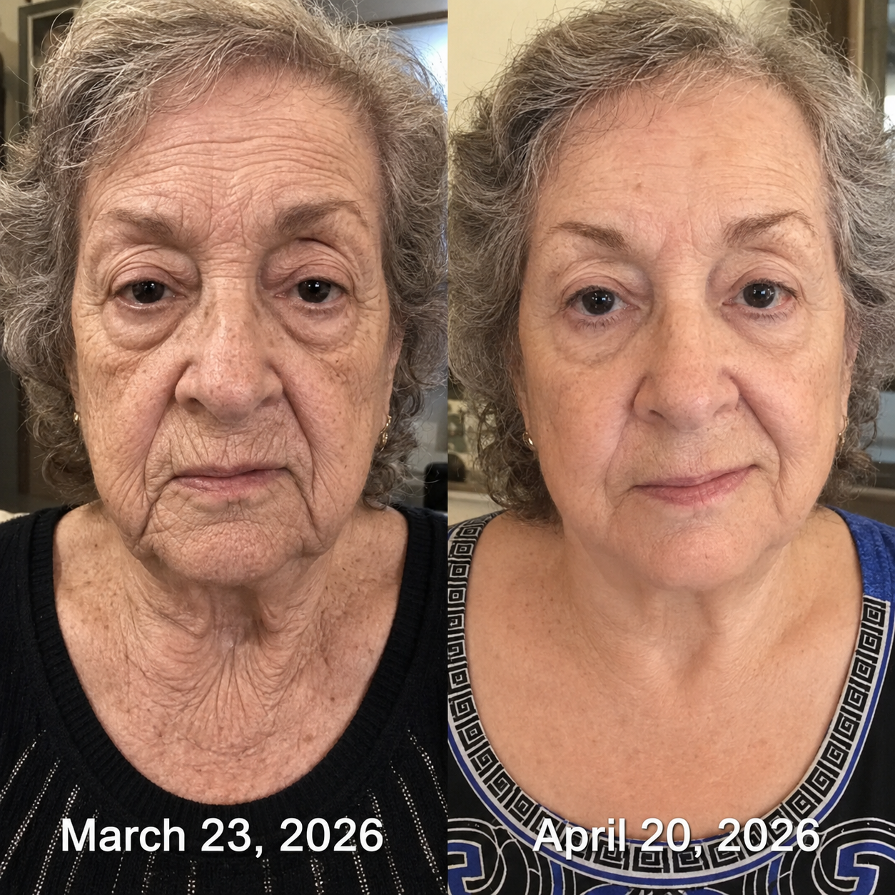 Real customer before and after feedback showing smoother-looking mature facial skin