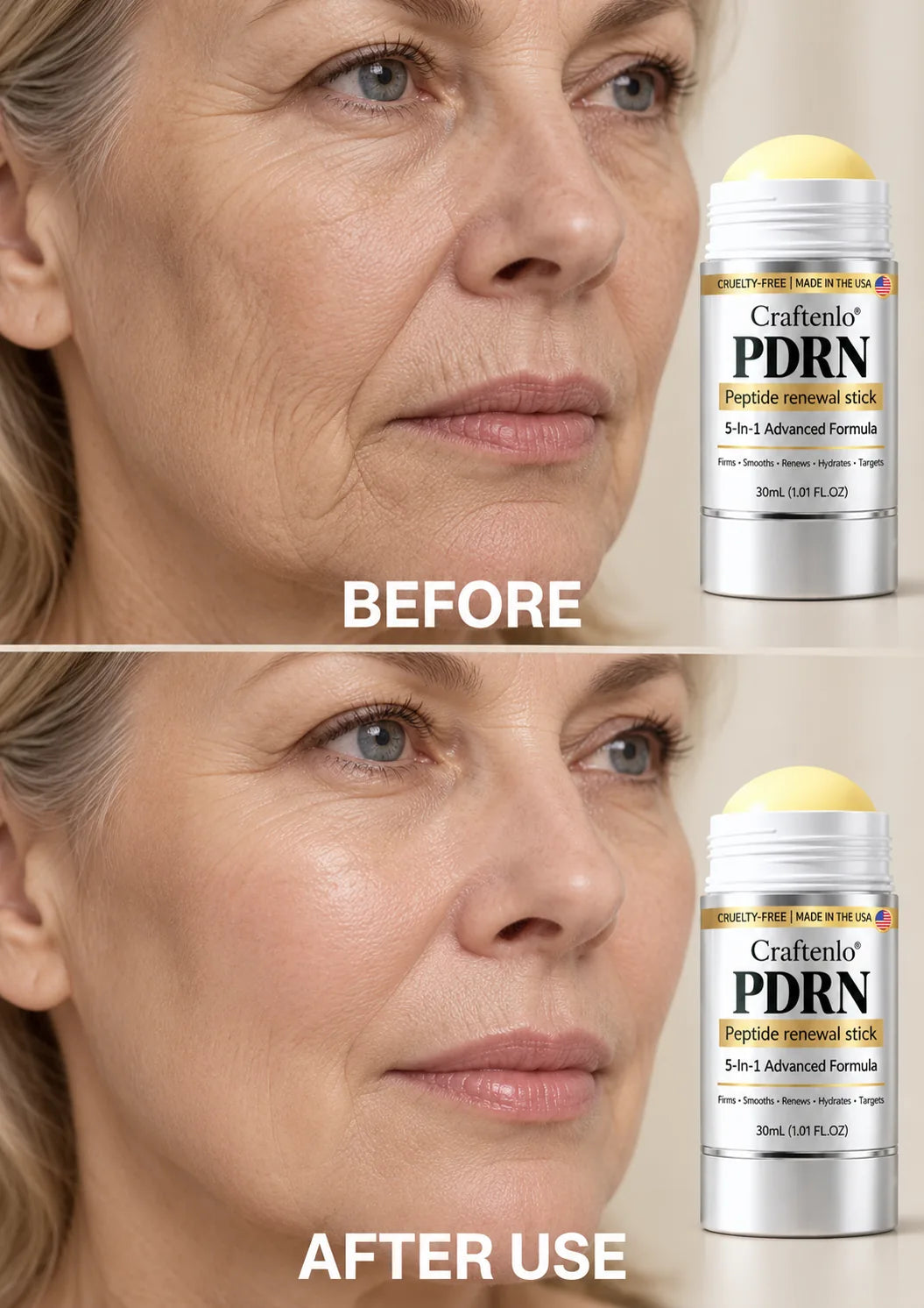 Before and after mature skin wrinkle appearance