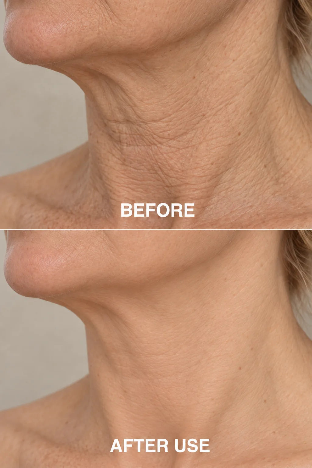Wrinkle texture before and after comparison