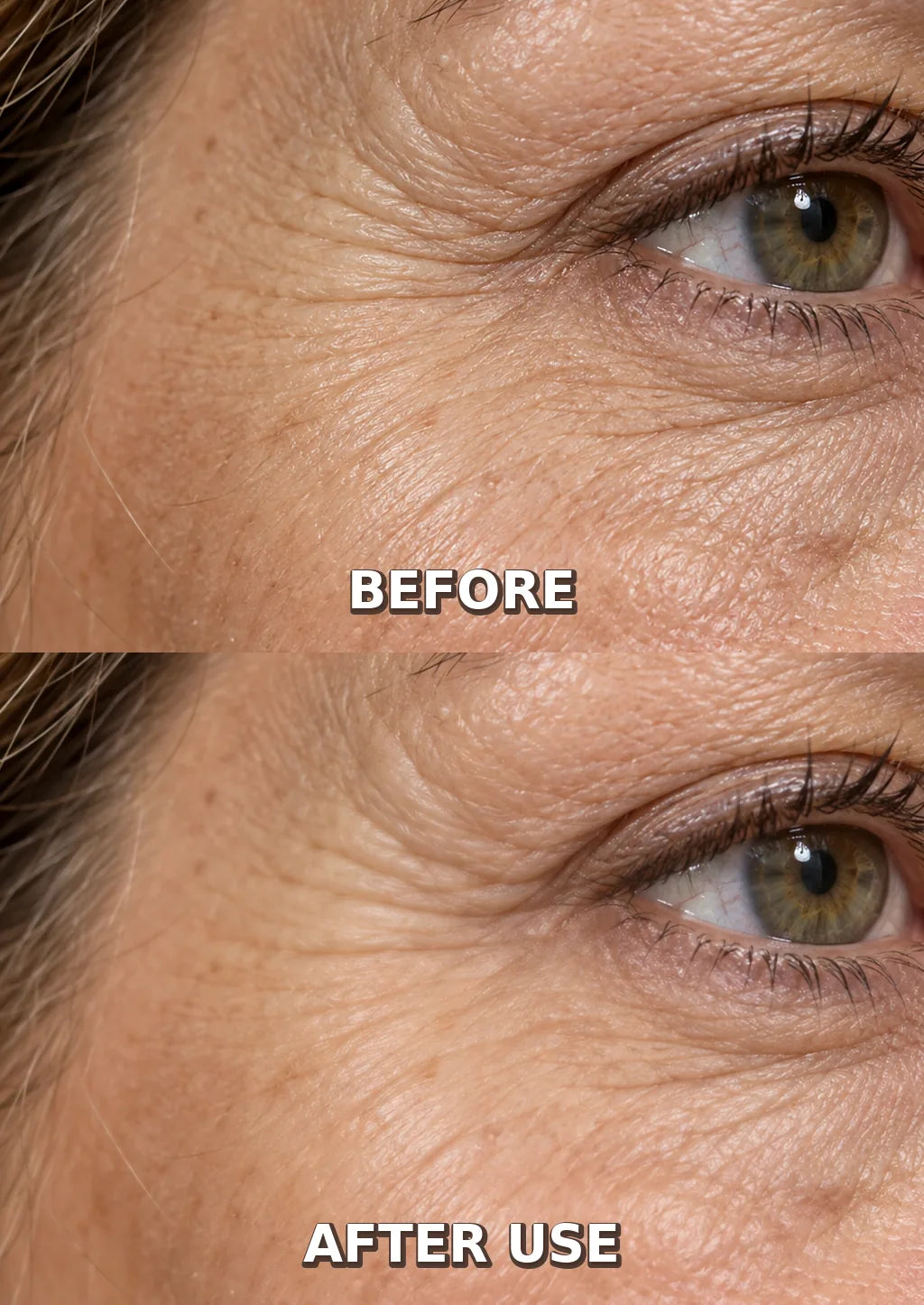 At-home wrinkle care comparison