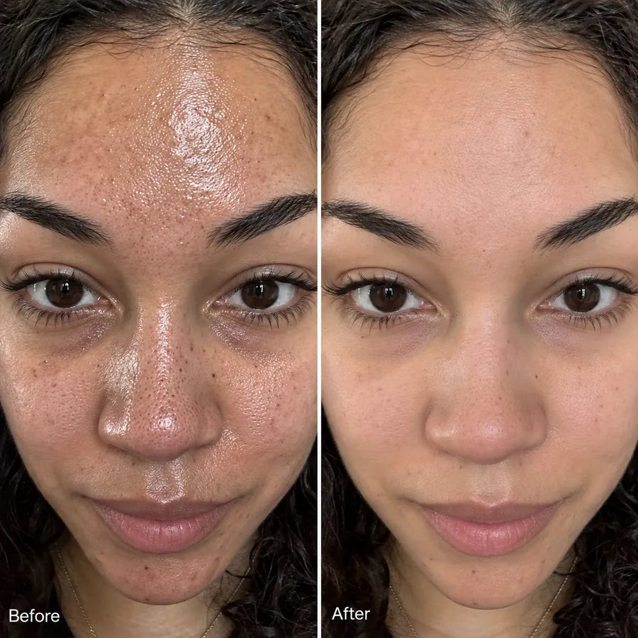 Before and after side cheek blemish skincare result