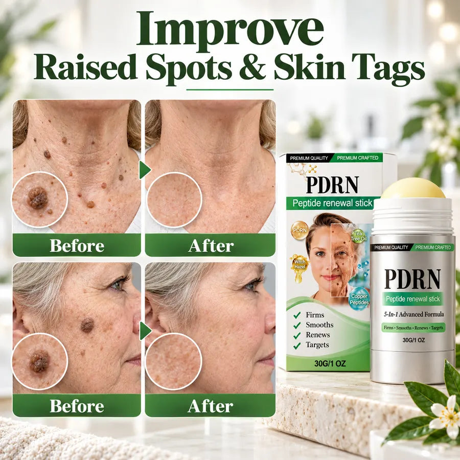 Visible spot and skin appearance comparison for targeted PDRN peptide care