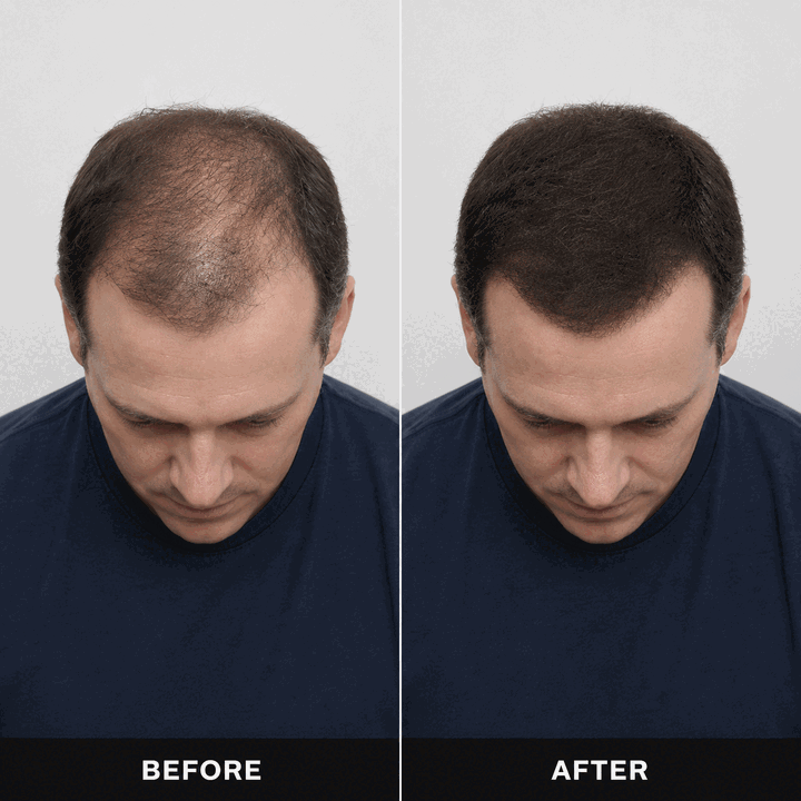 NAVOZILO before and after hair volume comparison