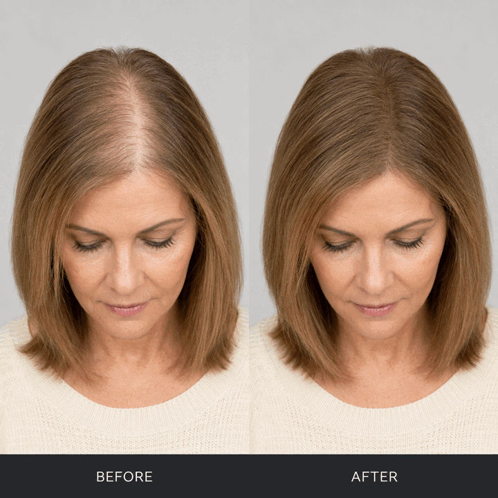 NAVOZILO before and after hair volume comparison