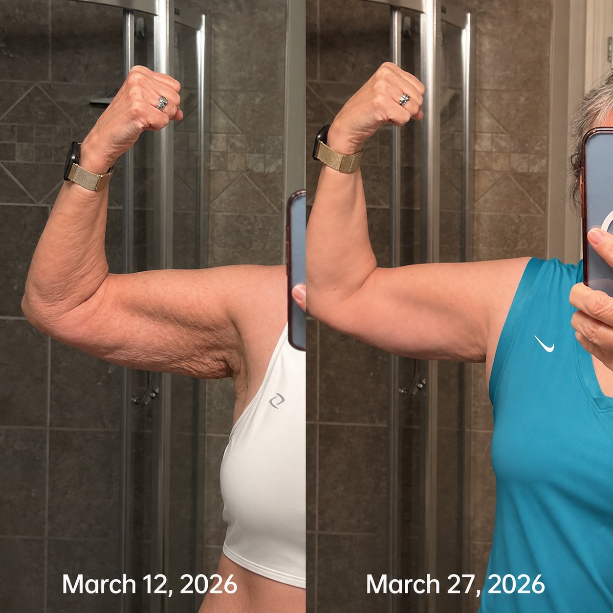 Real customer before and after feedback showing firmer-looking upper arm skin