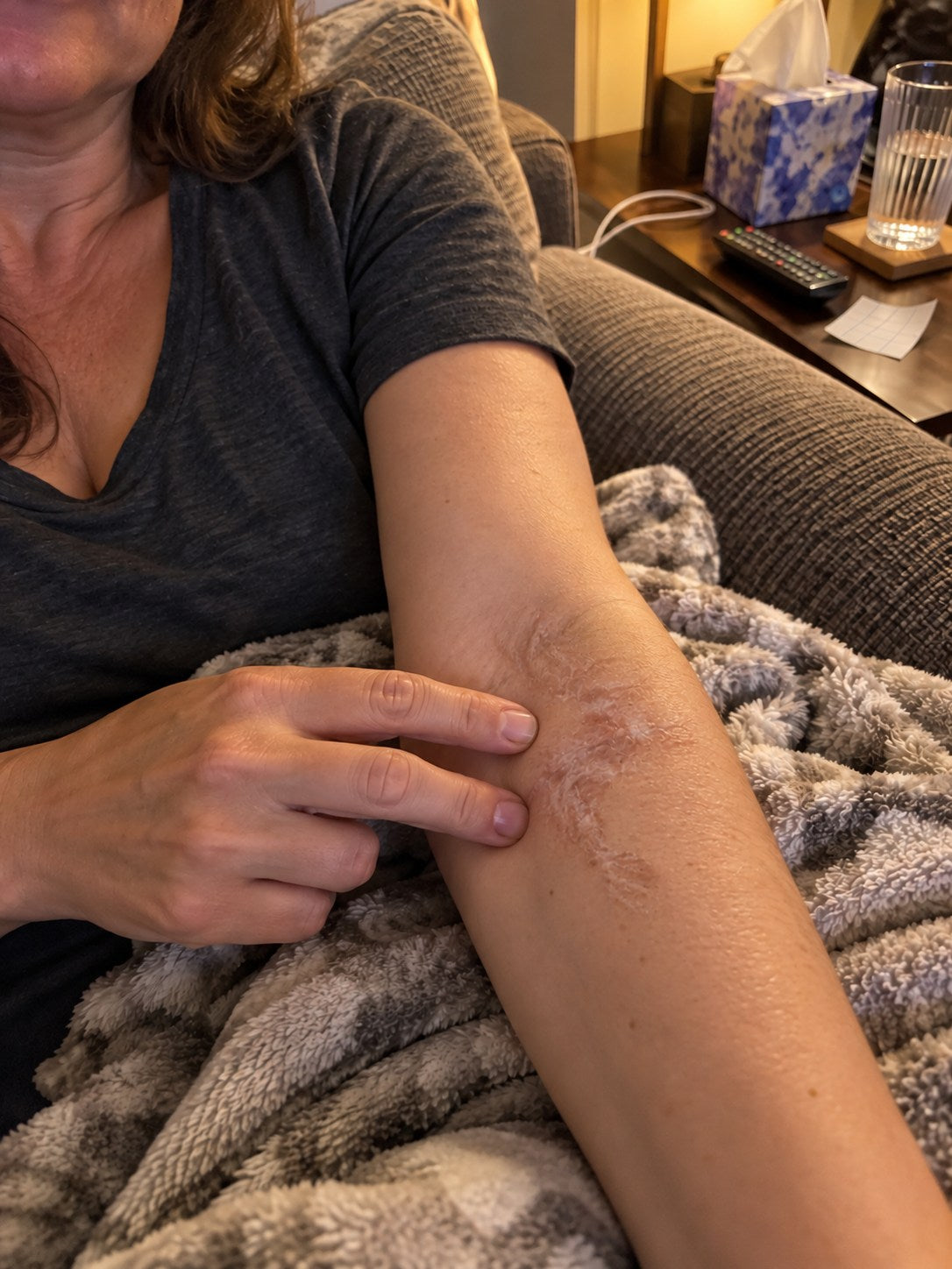 TRILUMIA burn scar care