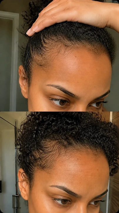Week 0 and week 12 hairline comparison