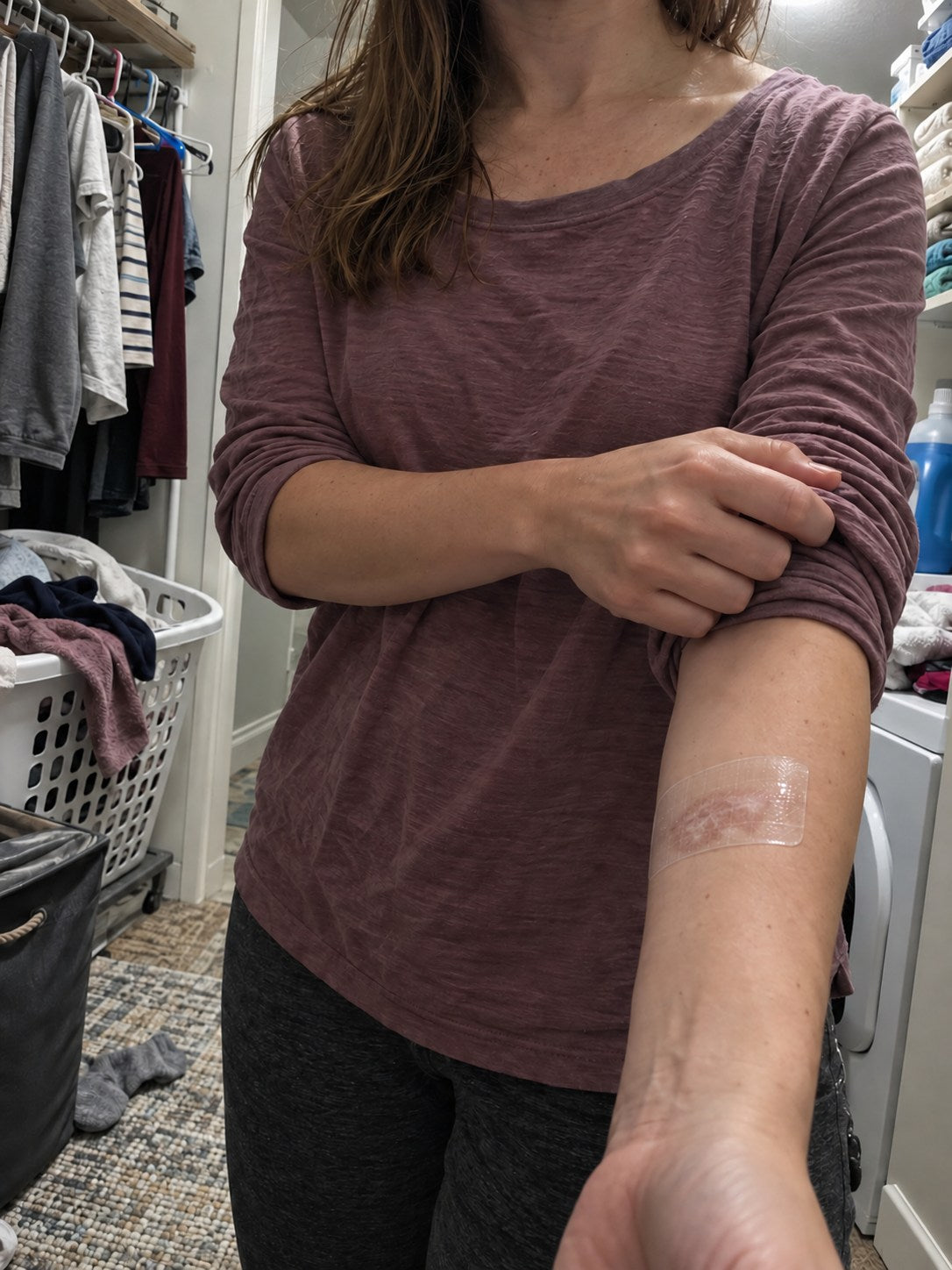 TRILUMIA burn scar care