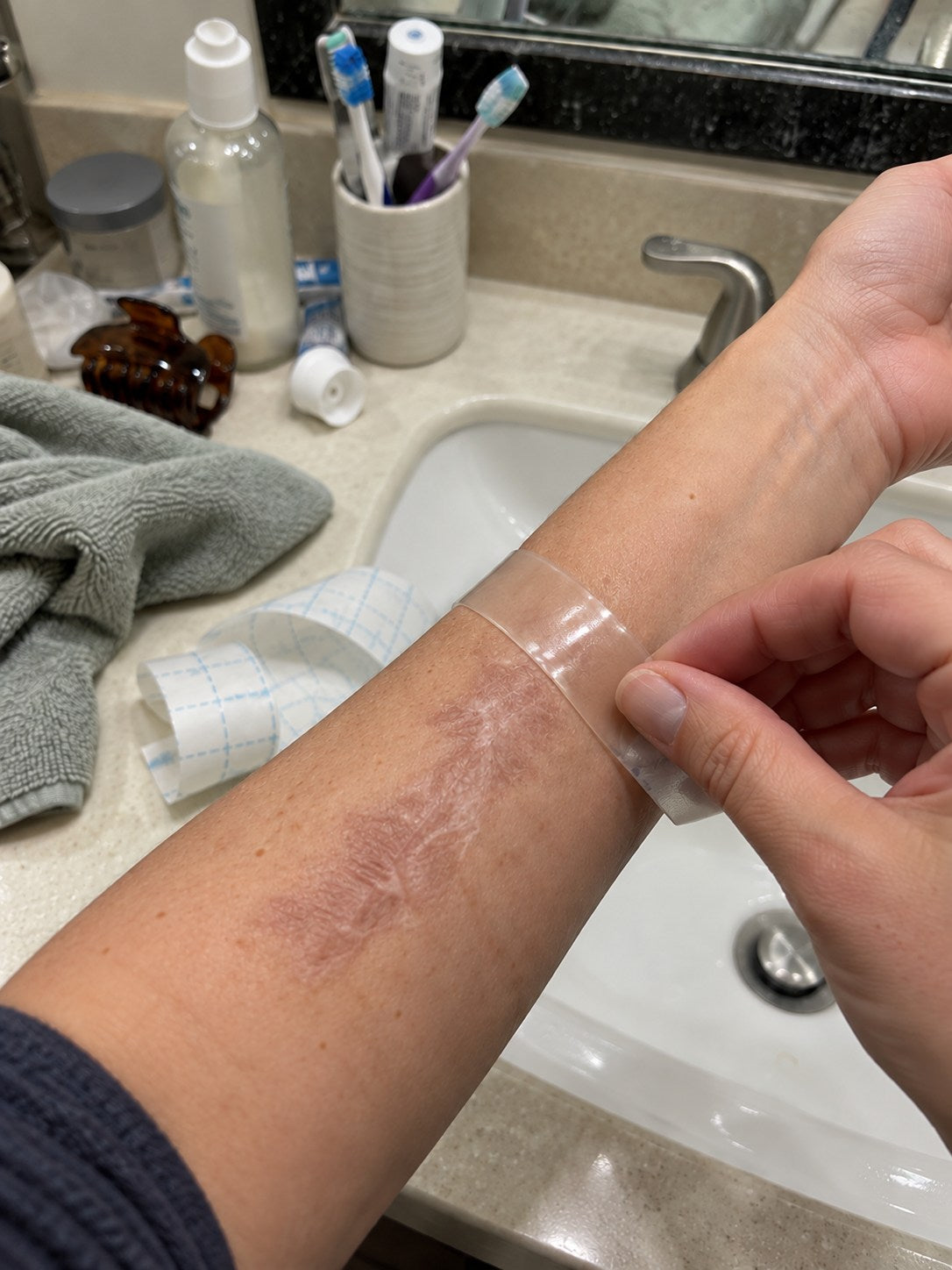 TRILUMIA burn scar care