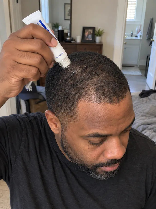 Man applying roll-on scalp serum along the front hairline