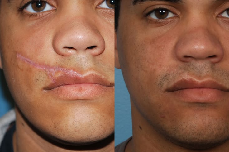 Scar comparison example 2