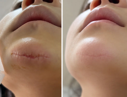 Scar comparison example 9