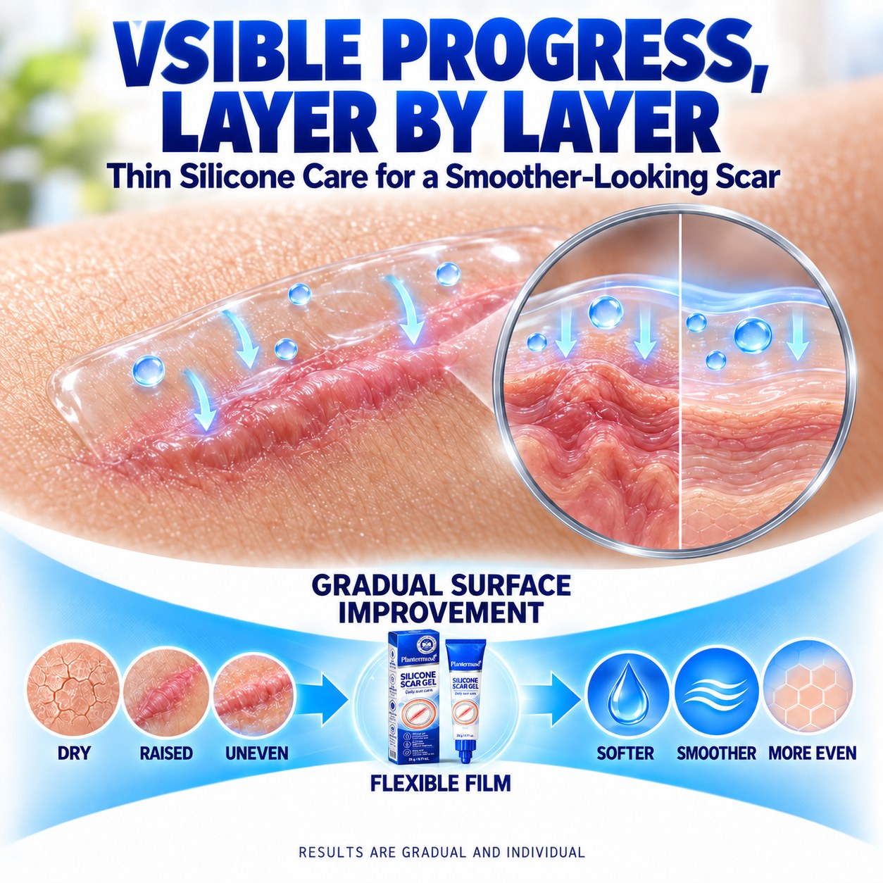 Layer-by-layer silicone scar care supporting gradual surface improvement